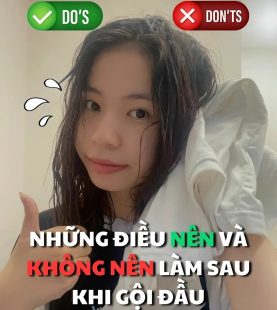 nhung dieu nen va khong nen lam sau goi can ghi nho